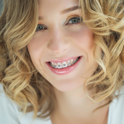 Marc H Berley, DMD | Teeth Whitening, Dental Bridges and Invisalign reg 