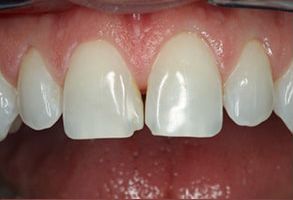 Marc H Berley, DMD | Crowns  amp  Caps, Periodontal Treatment and Dental Fillings